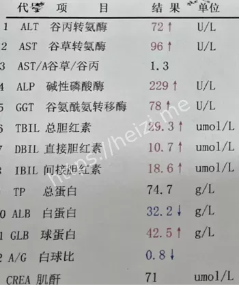 23岁青少年自慰死亡事件